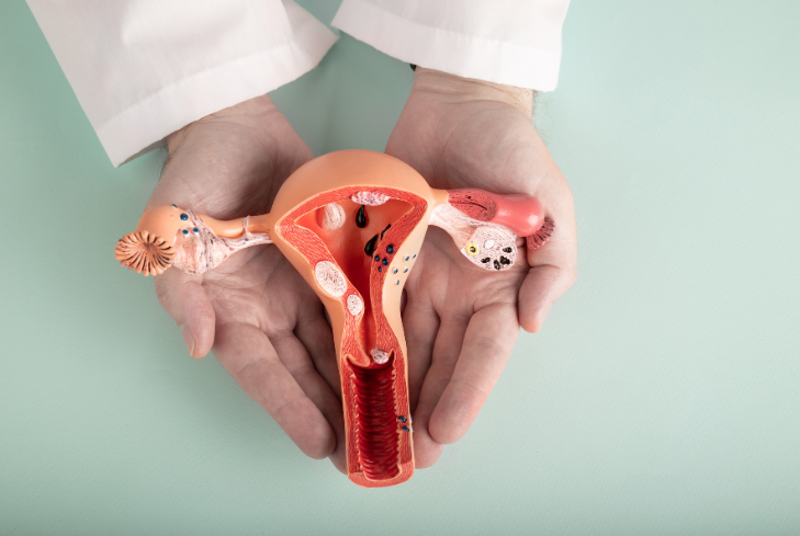 Strengthening Support for Menopause after Gynaecological Cancer